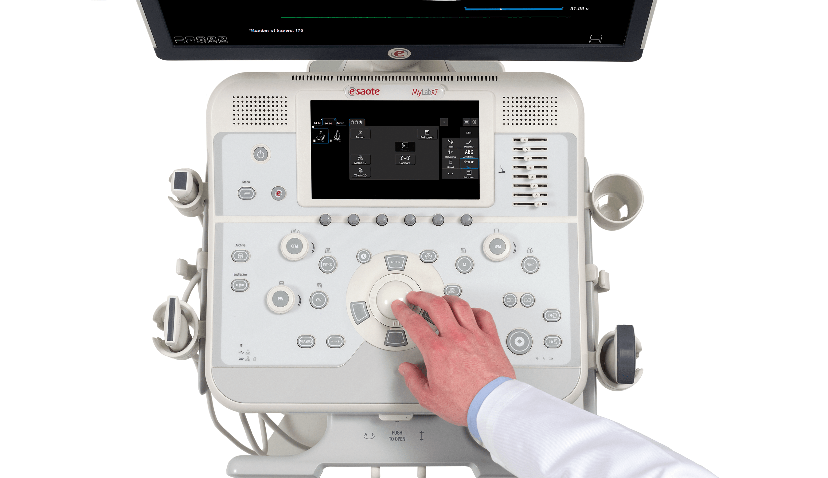 MyLab™X7 Esaote ultrasound