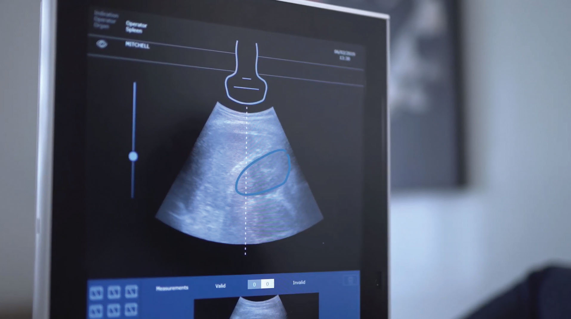 FibroScan® Expert 630 - Echosens