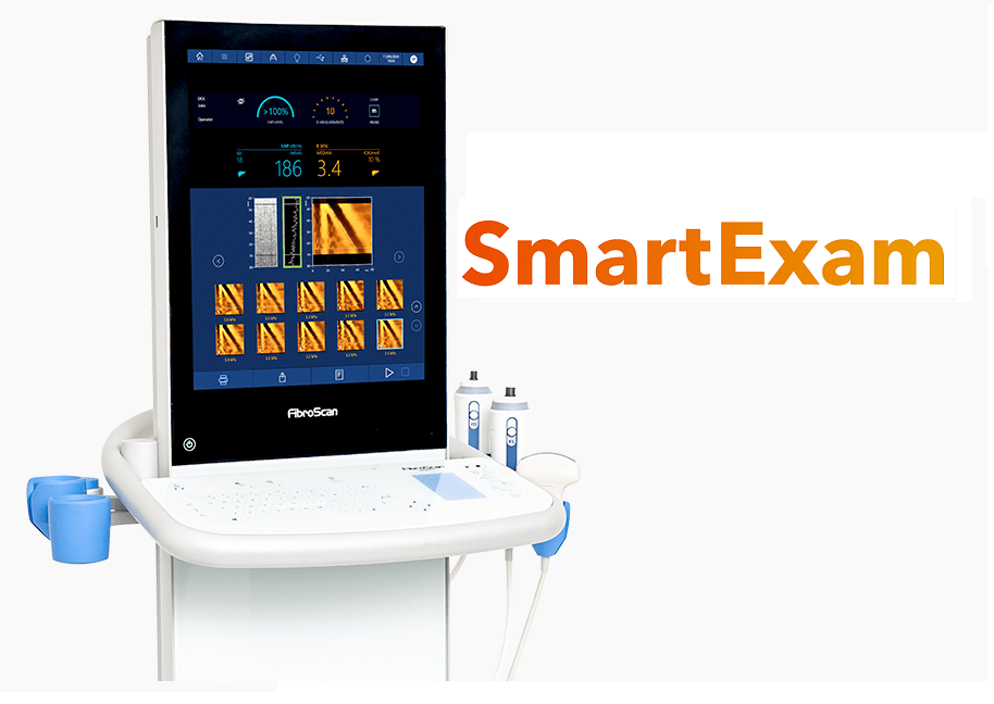 FibroScan® Expert 630 - Echosens