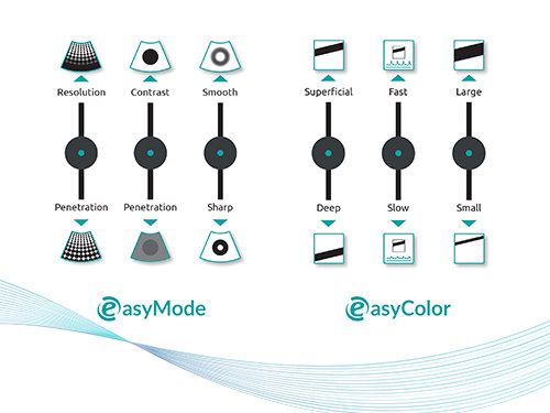 MyLab™X75 Esaote ultrasound