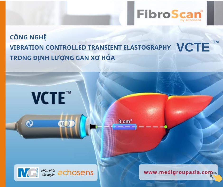 VCTE  định lượng xơ hóa gan