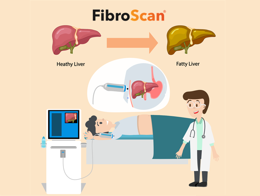 FibroScan-ky-thuat-khong-xam-lan-chuyen-biet-cho-gan