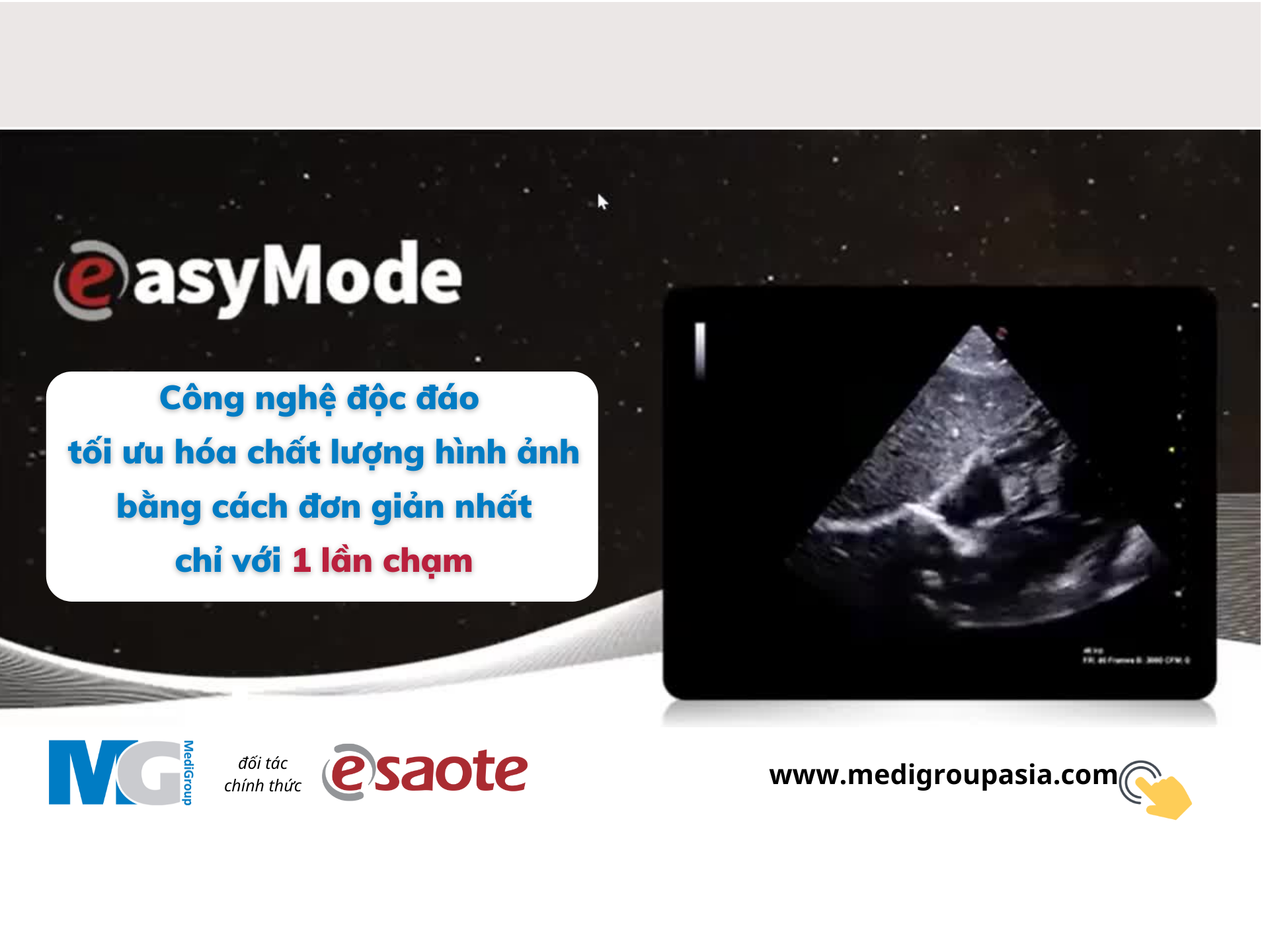 cong-nghe-easyMode-esaote