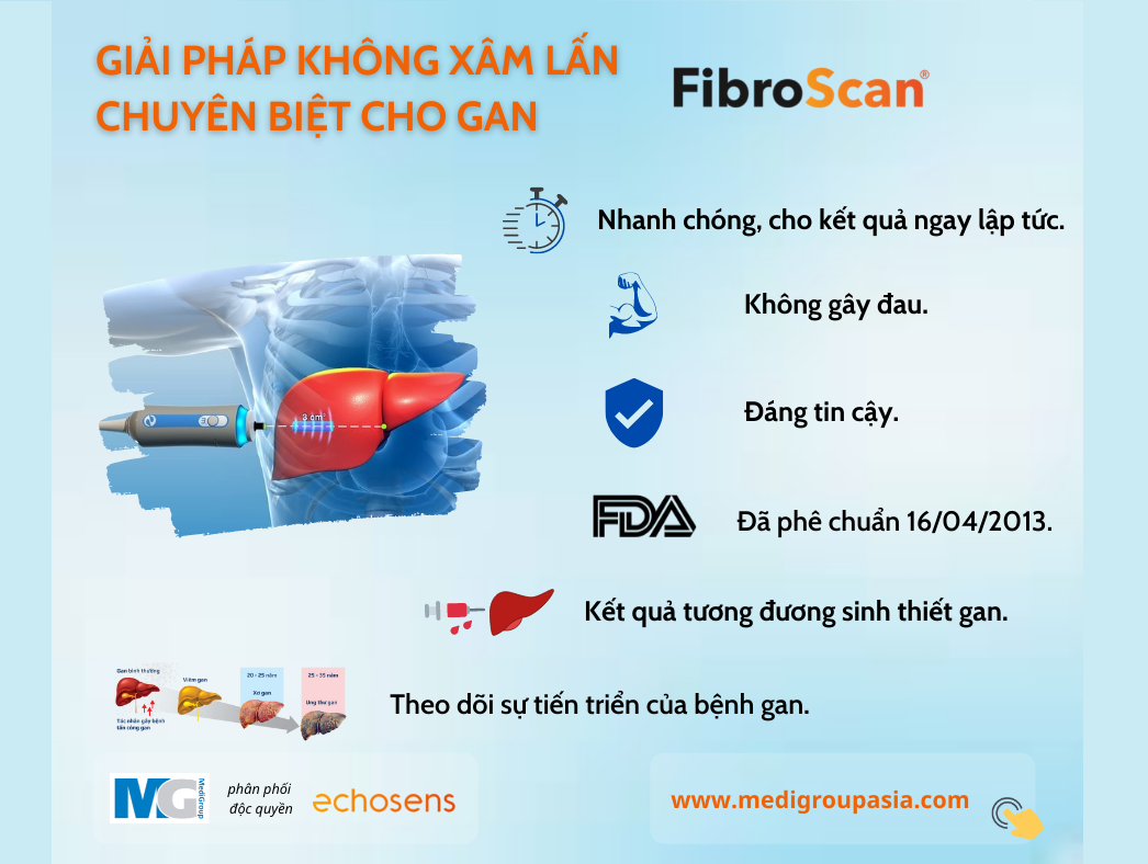 FibroScan-giai-phap-khong-xam-lan-chuyen-biet-cho-gan-echosens