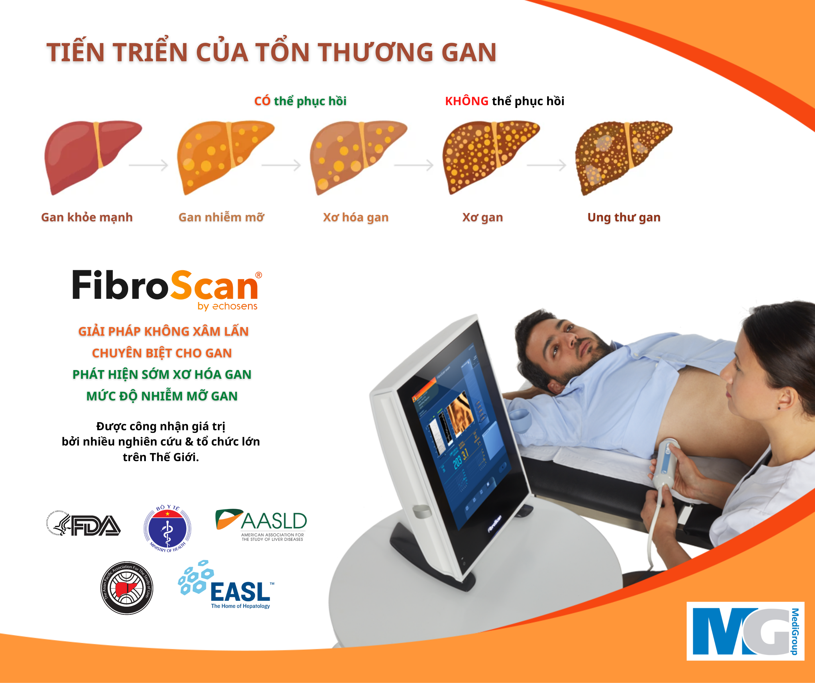 FIBROSCAN-giai-phap-khong-xam-lan-chuyen-biet-cho-GAN