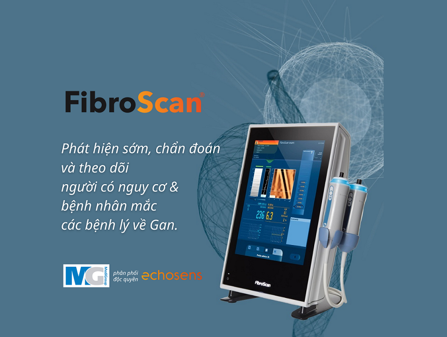 FibroScan-phat-hien-som-chan-doan-dieu-tri-benh-nhan-nguy-co-benh-gan-xo-hoa-gan-nhiem-mo-echosens