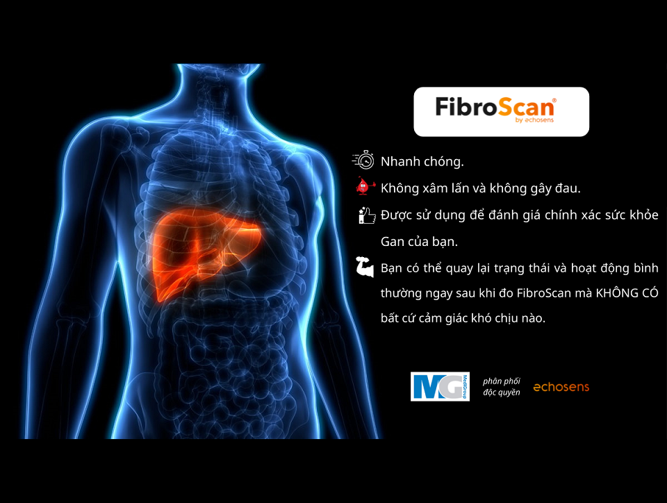 Fibroscan-echosens-tam-soat-phat-hien-som-benh-ly-gan-nhiem-mo-gan-xo-hoa-medigroup