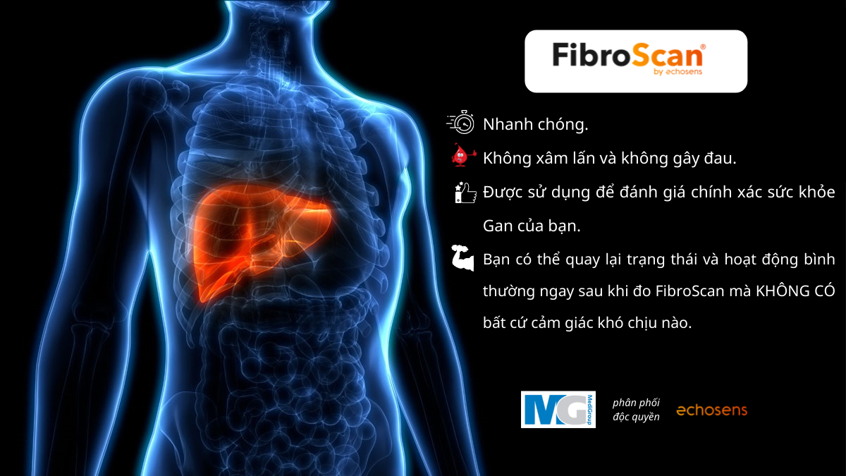 Fibroscan-echosens-tam-soat-phat-hien-som-benh-ly-gan-nhiem-mo-gan-xo-hoa