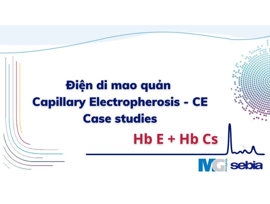 CE-Case-study-HbE-HbCs-dien-di-mao-quan-sebia-Capillary-Electropherosis-Hb E + Hb Cs