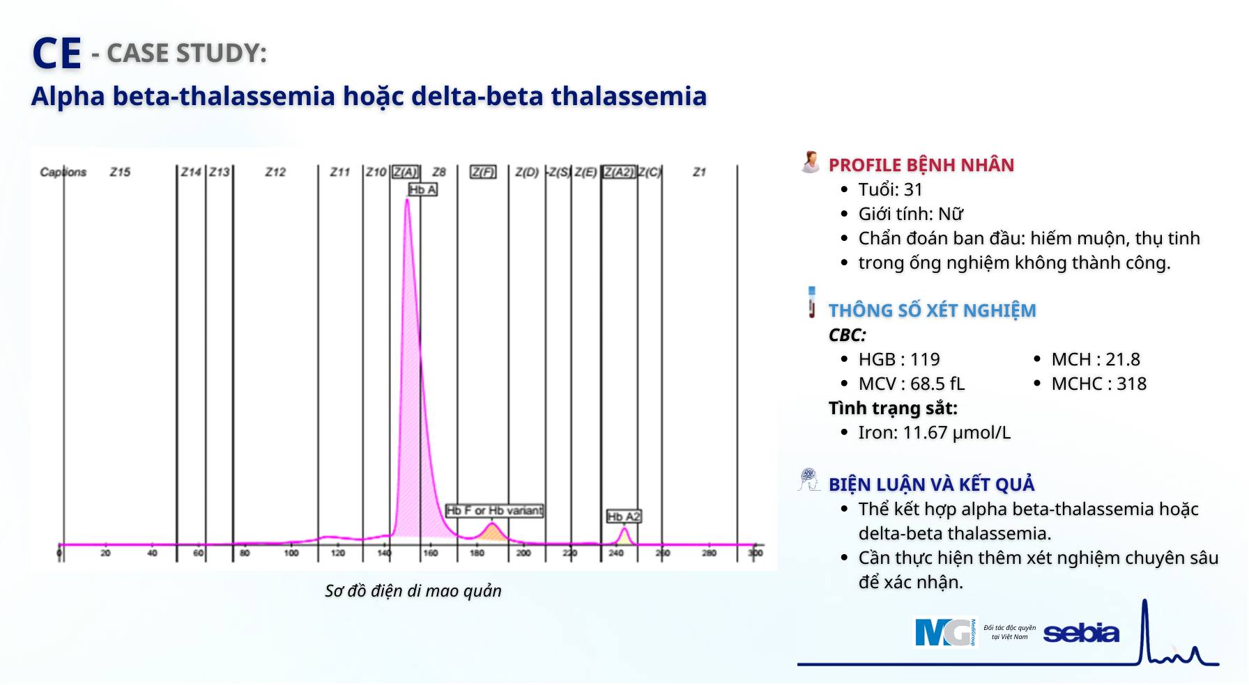 Case-study-CE-dien-di-mao-quan-Sebia-Alpha beta-thalassemia-delta-beta thalassemia