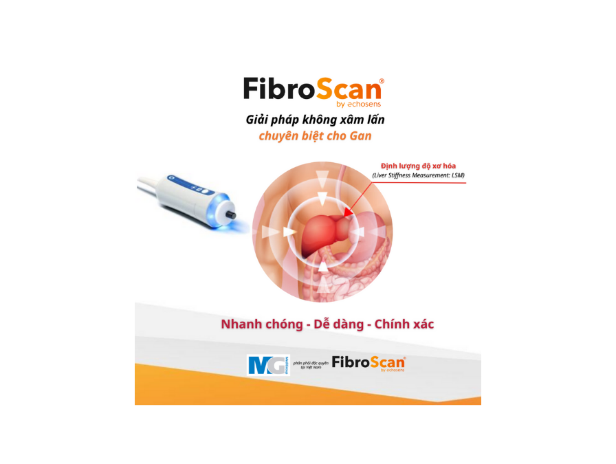 FibroScan-Giải pháp không xâm lấn chuyên biệt cho Gan- liver Stiffness Measurement LSM-xo-hoa-gan