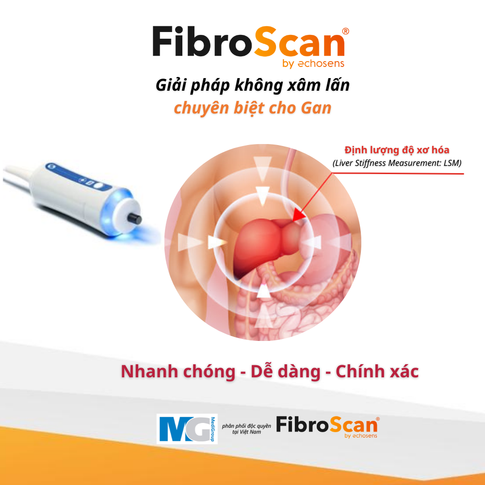 FibroScan-Giải pháp không xâm lấn chuyên biệt cho Gan- liver Stiffness Measurement LSM