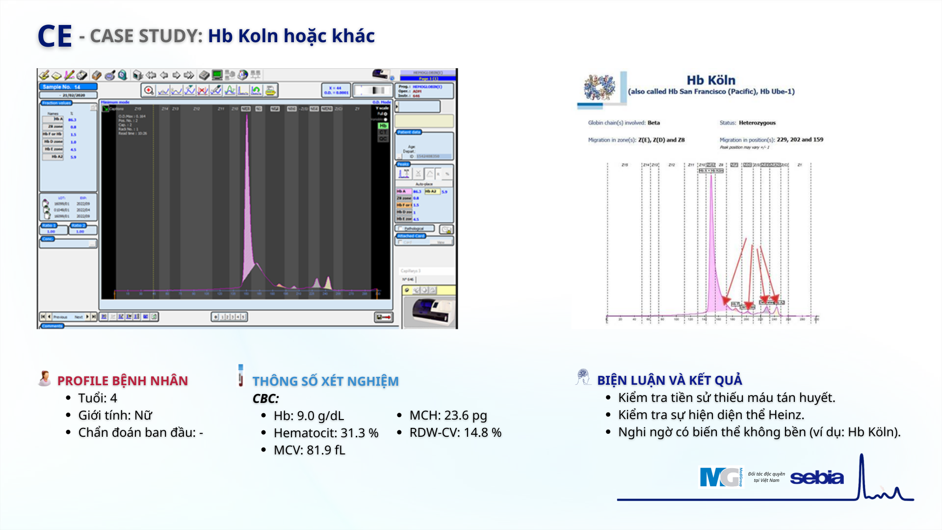 Case-study-CE-dien-di-mao-quan-Sebia-Hb-Koln 