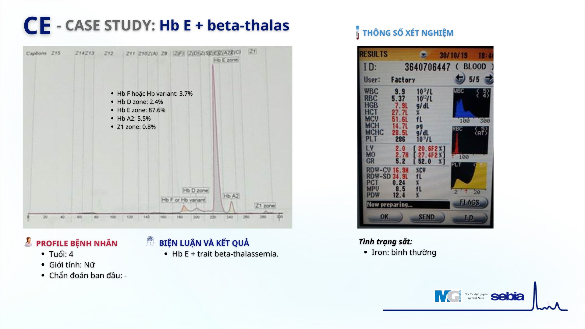 Case-study-CE-dien-di-mao-quan-Sebia-Hb E with beta-thalas