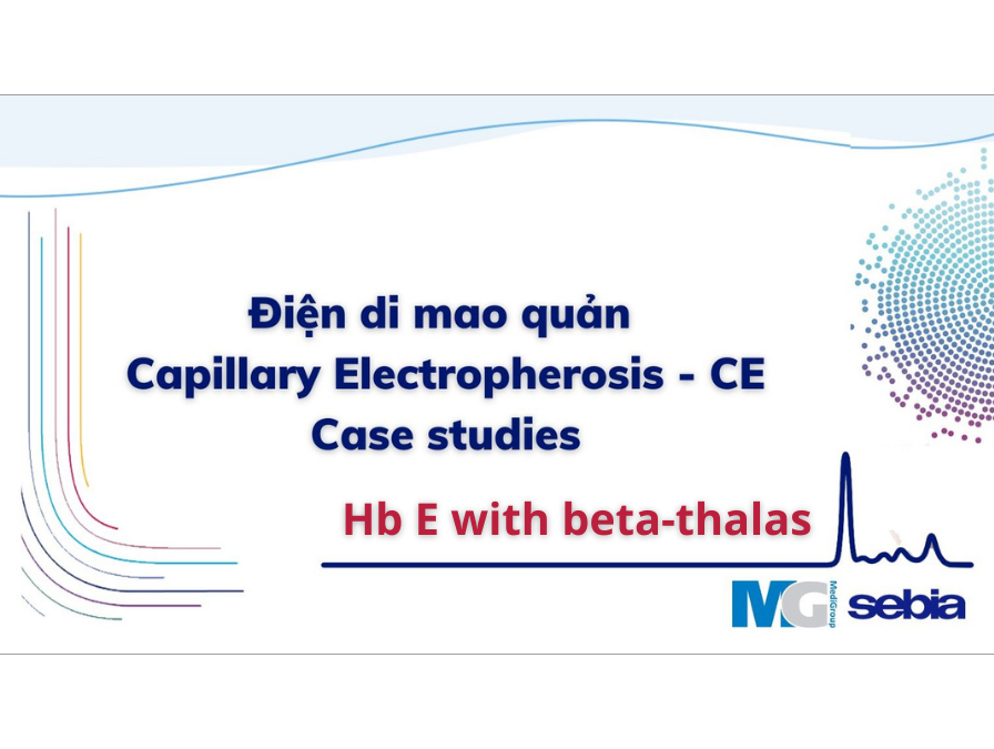 Case-study-CE-dien-di-mao-quan-Sebia-Hb-E-with-beta-thalas