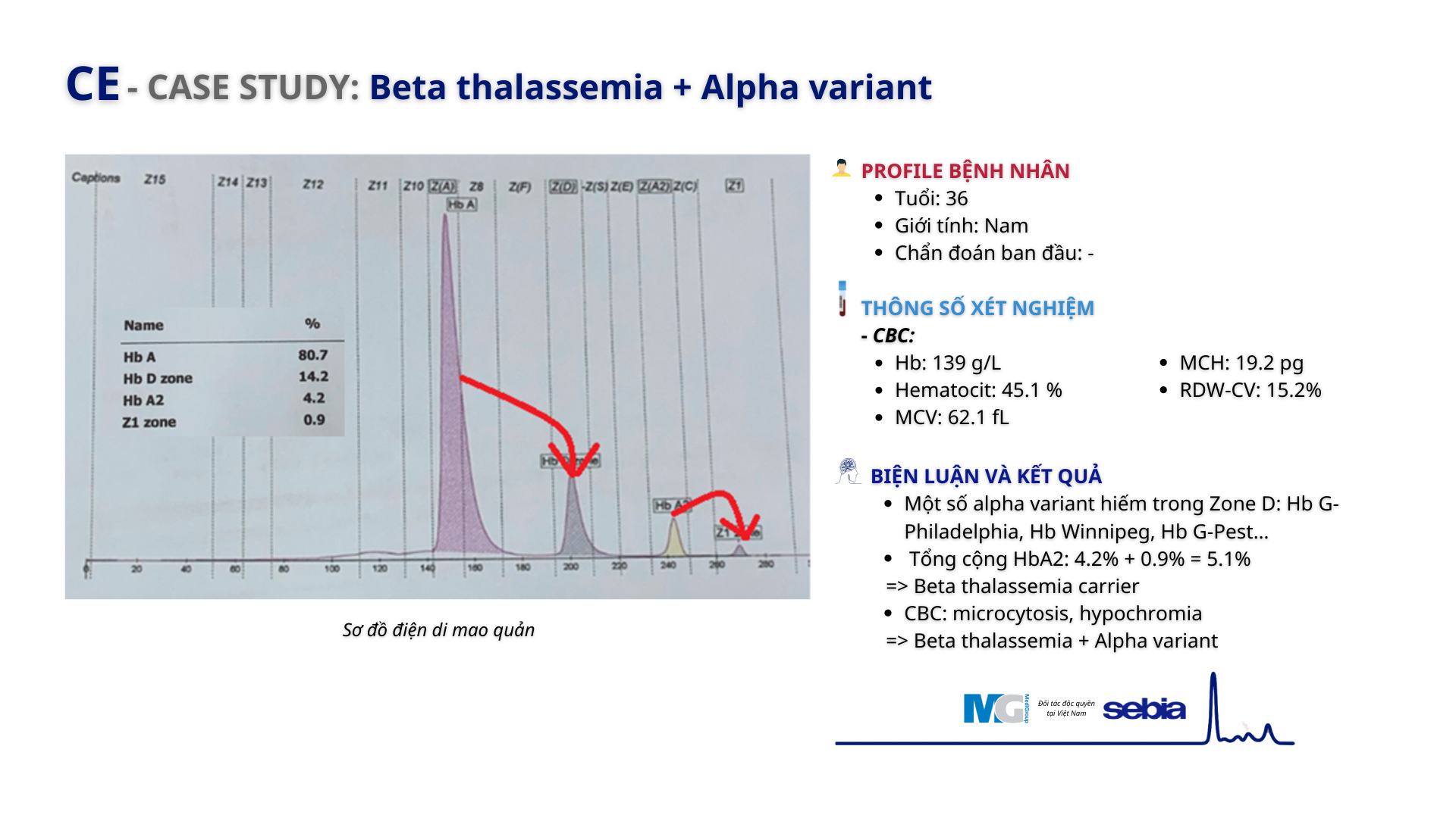 CE case study beta thalassemia Alpha variant