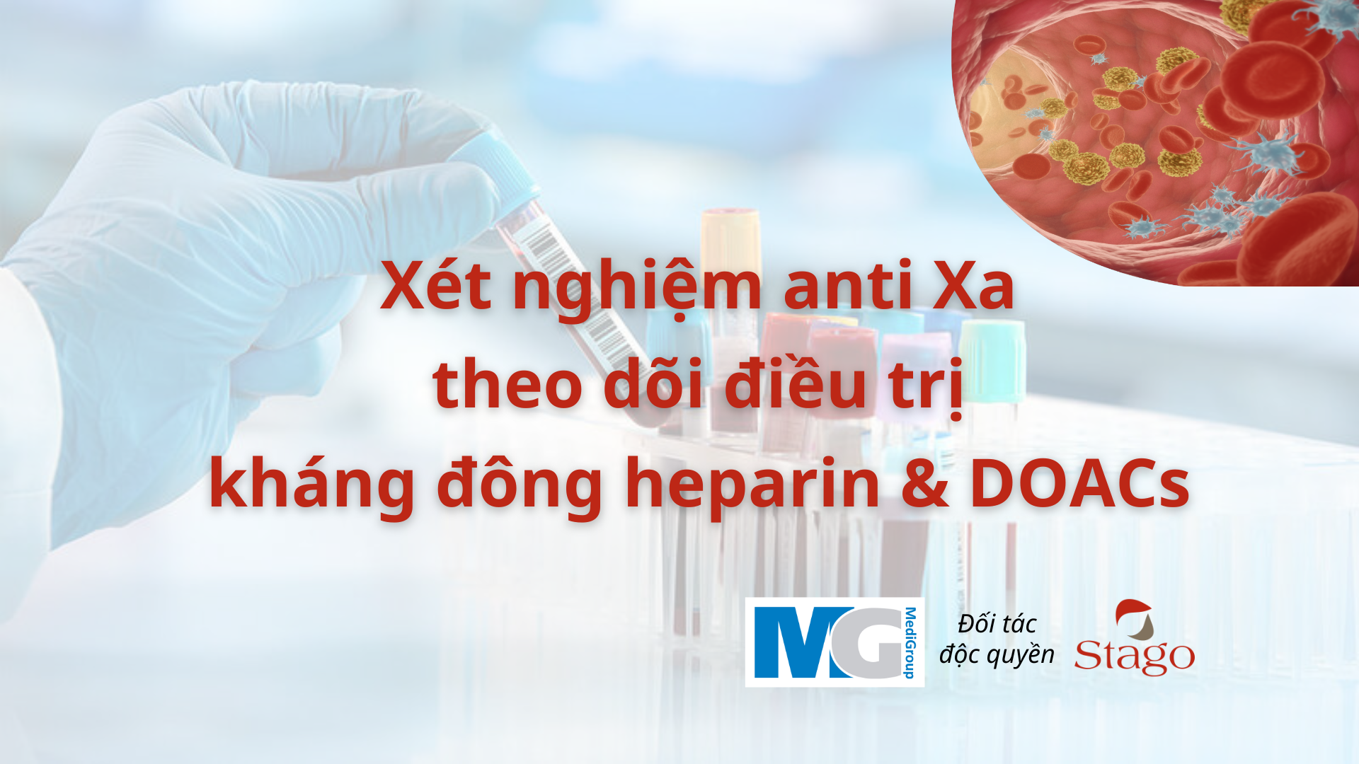 Xét nghiệm anti Xa theo dõi điều trị kháng đông heparin & DOACs