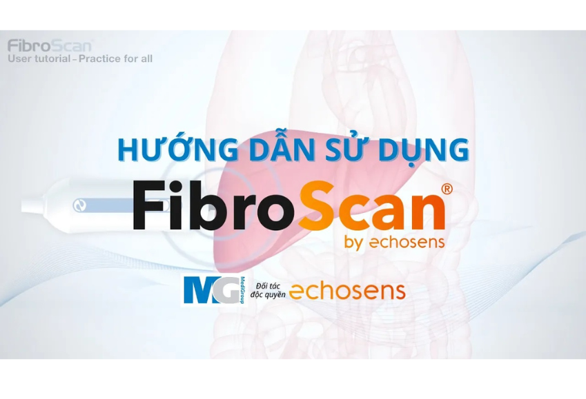 Hướng dẫn sử dụng Fibroscan