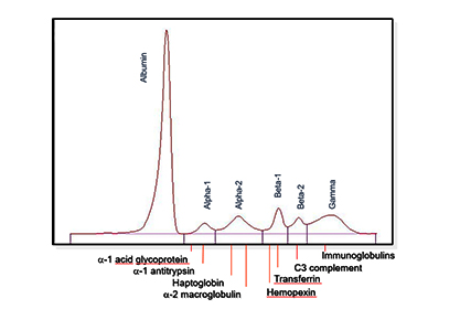 so-do-dien-di-protein-huyet-thanh-sebia-medigroup-viet-nam